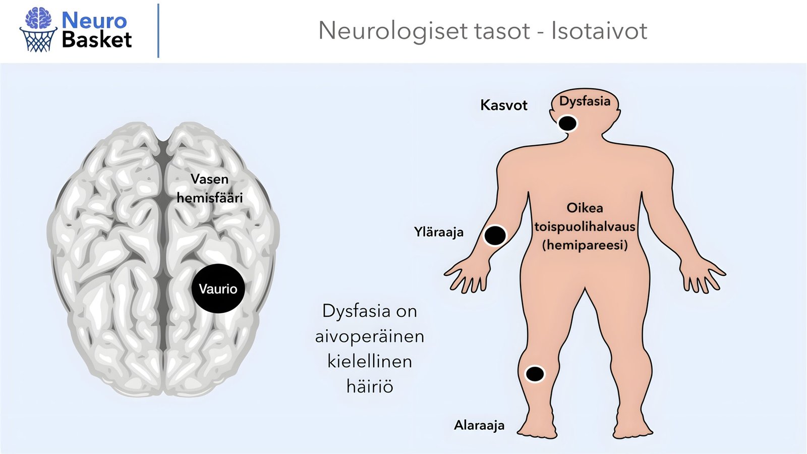 Oikea hemisfääri